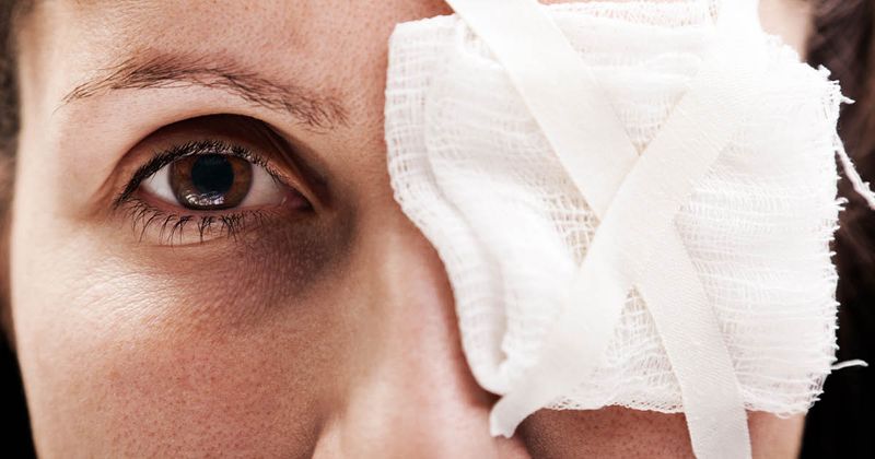 Woman wearing eye bandage