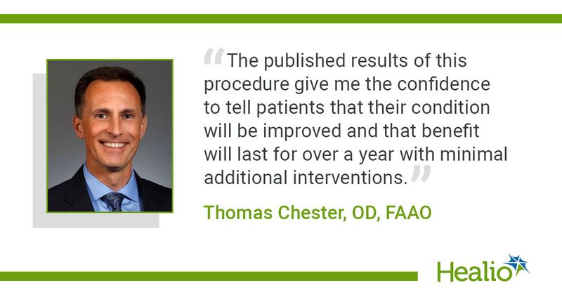 “The published results of this procedure give me the confidence to tell patients that their condition will be improved and that benefit will last for over a year with minimal additional interventions.” Thomas Chester, OD, FAAO