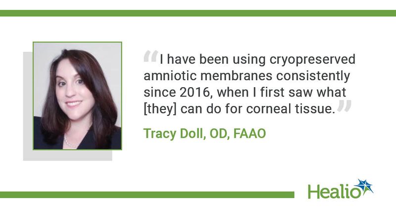 “I have been using cryopreserved amniotic membranes consistently since 2016, when I first saw what [they] can do for corneal tissue.” Tracy Doll, OD, FAAO