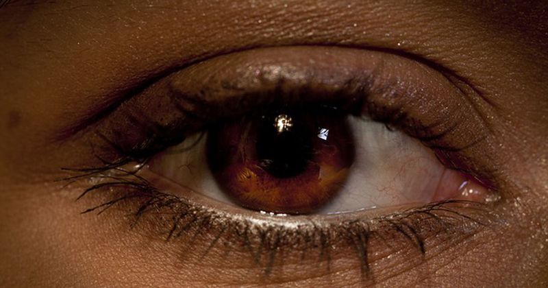 Image of a brown eye. 