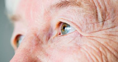 Combination SLT, resveratrol supplementation improves optic nerve health in glaucoma