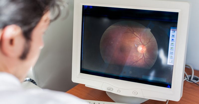 retinal imaging