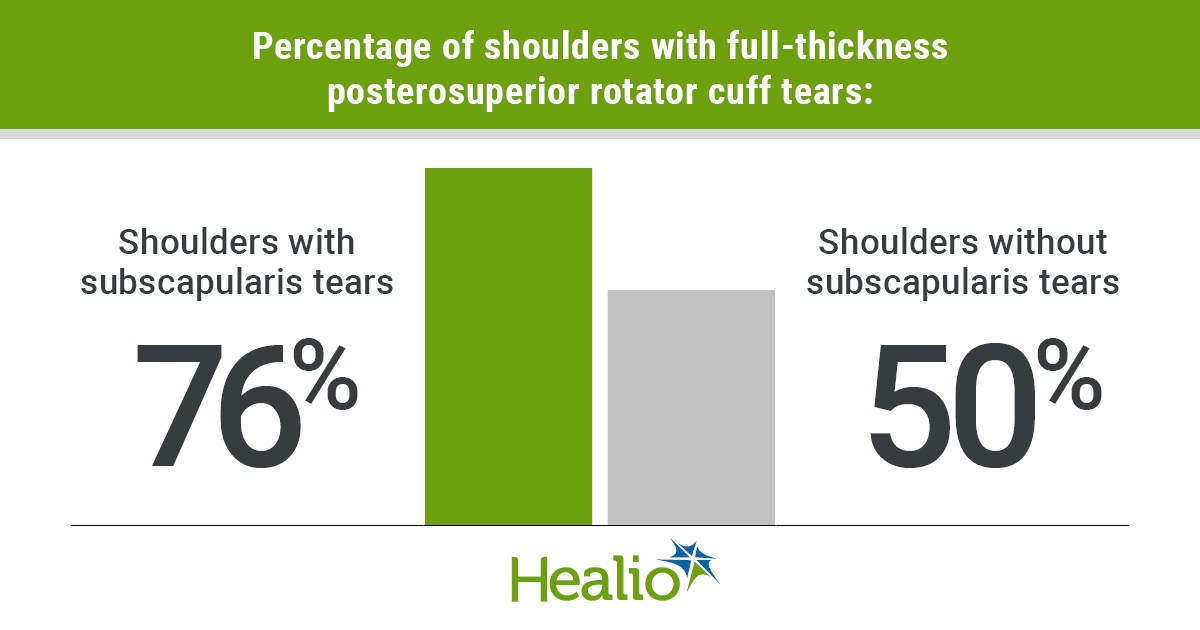   Results showed 76% of shoulders that developed subscapularis tears had full-thickness posterosuperior rotator cuff tears vs. 50% that did not develop subscapularis tears.