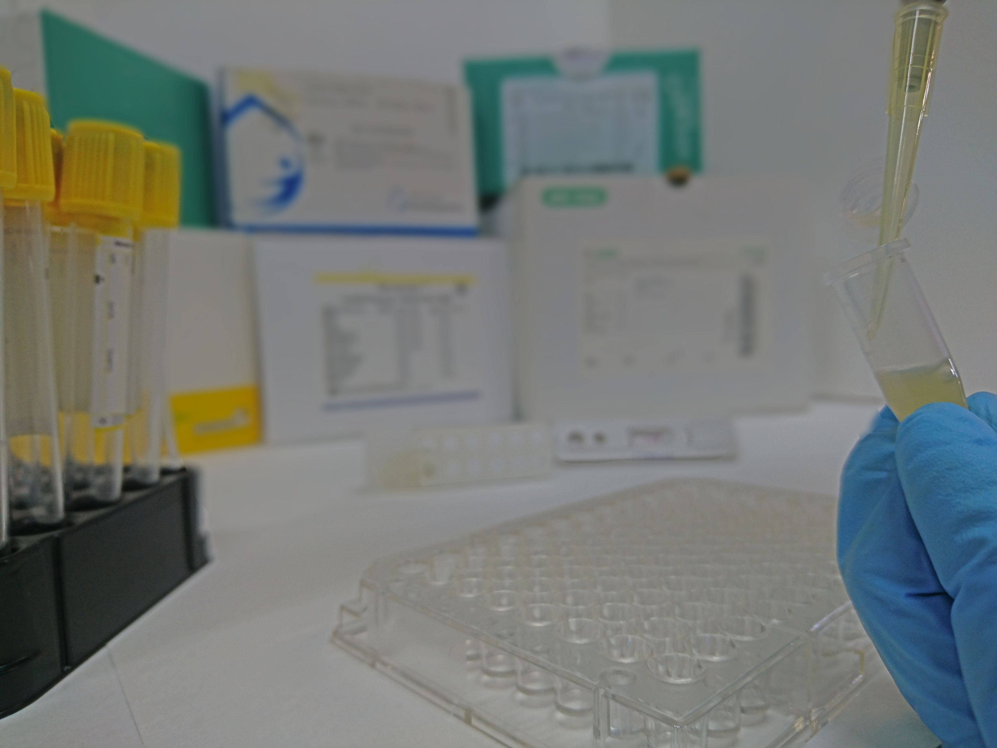 Photo of serological tests for visceral leishmaniasis