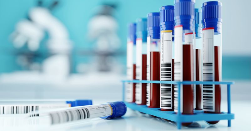 New blood test may identify Alzheimer’s disease-related pathology up to 10 years before symptom onset. Image: Adobe Stock