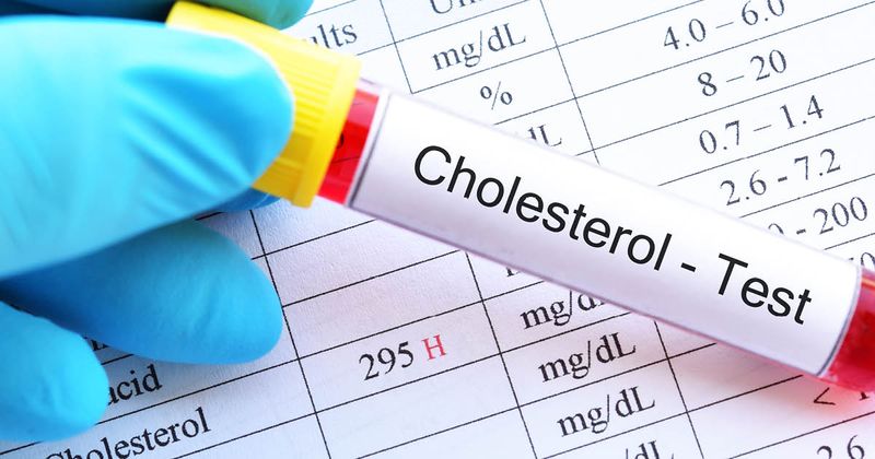 Cholesterol_Test_AdobeStock