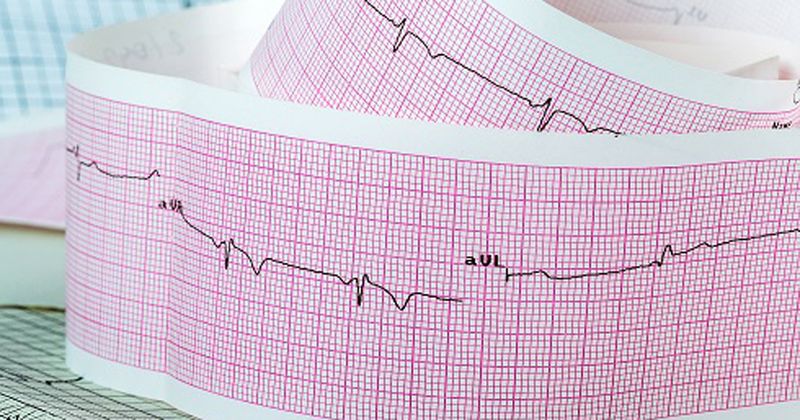 ECG reading