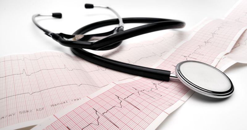 ECG with stethoscope_Shutterstock