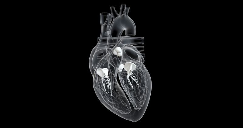 3D heart valves_175470830