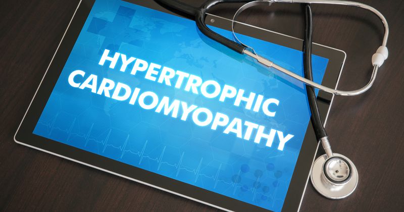 Hypertrophic cardiomyopathy_140849465