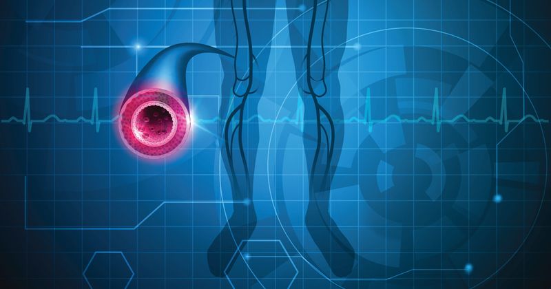 normal artery