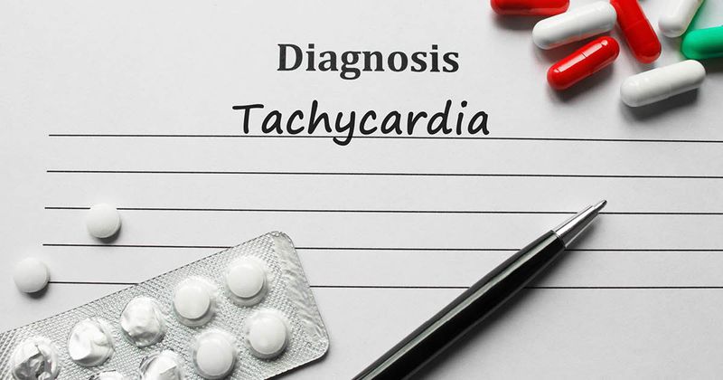 Tachycardia_AdobeStock