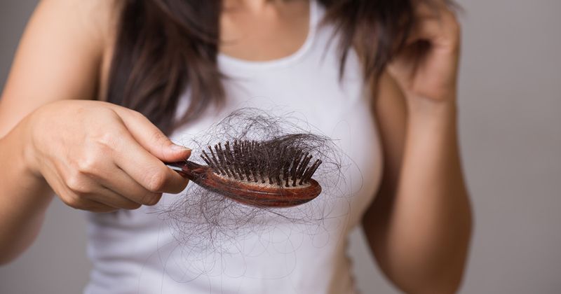 Woman holds hairbrush containing hair lost to alopecia.