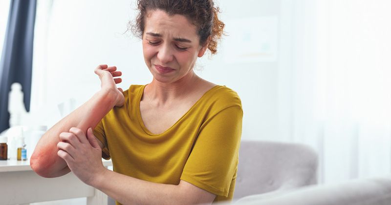 Woman in a yellow short scratches her arm. 