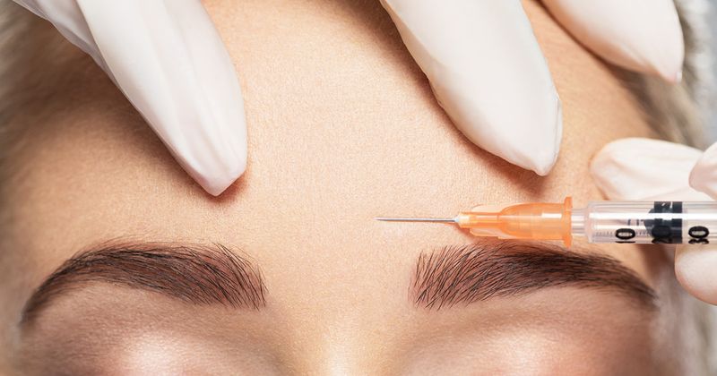 Needle being injected into the forehead. 