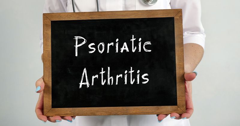 Psoriatic arthritis 2