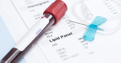 The year in lipids: Progress in Lp(a) management and a blow to the &lsquo;HDL hypothesis&rsquo;