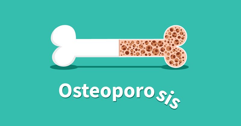 Osteoporosis cartoon Adobe