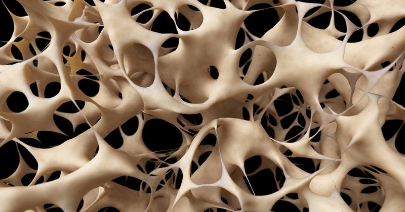 Osteoporosis closeup Adobe