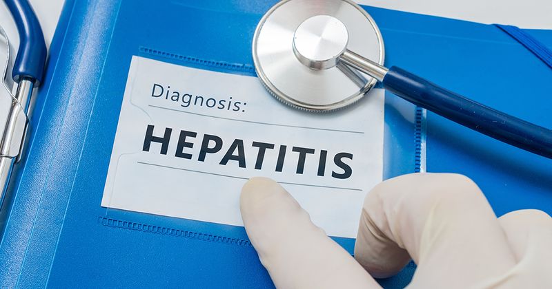 hepatitis diagnosis file