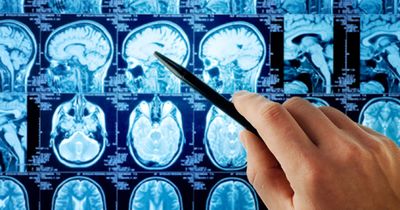 Trial to assess personalized vaccine for aggressive brain tumors