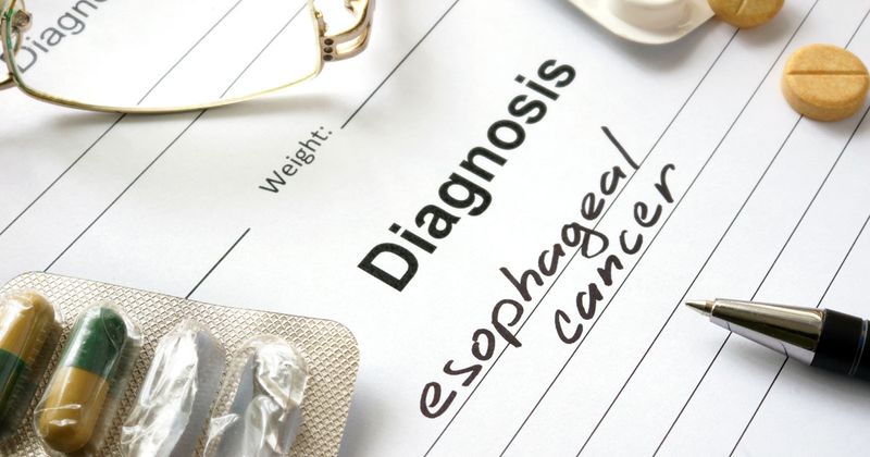 Diagnosis esophageal cancer written in the diagnostic form and pills.