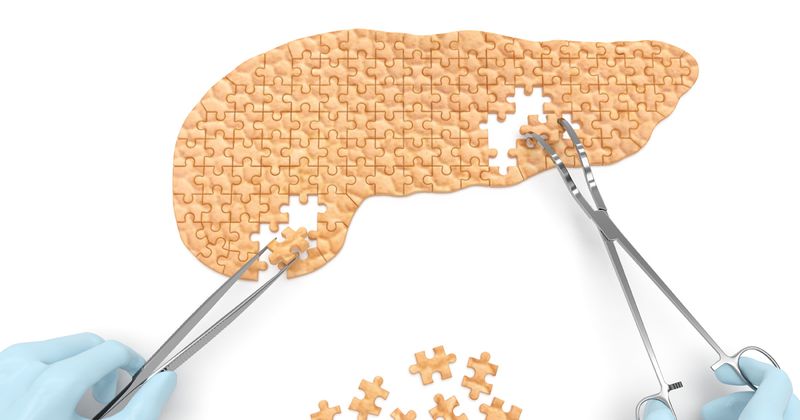 Pancreas as a puzzle