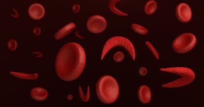 Lactated Ringer solution superior to normal saline for sickle cell vaso-occlusive episodes