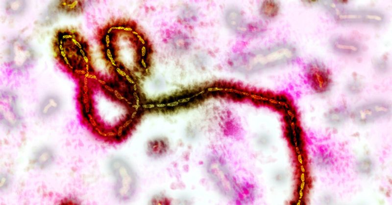 Microscopic image of Ebola virus