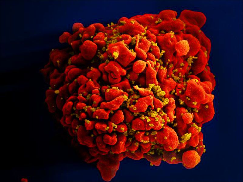 Image of an H9-T cell infected with HIV particles