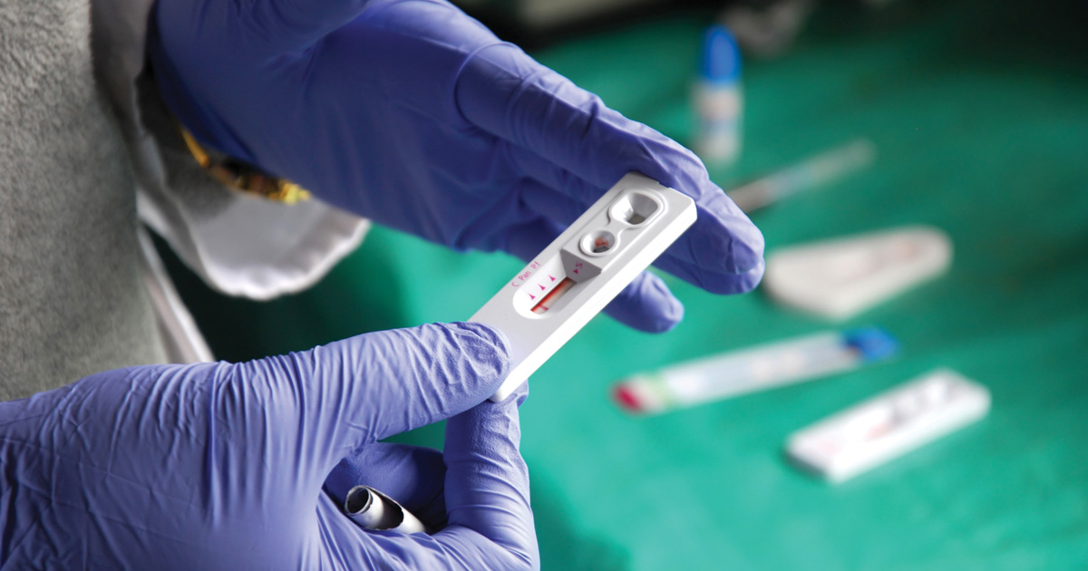 A photo of an HIV test