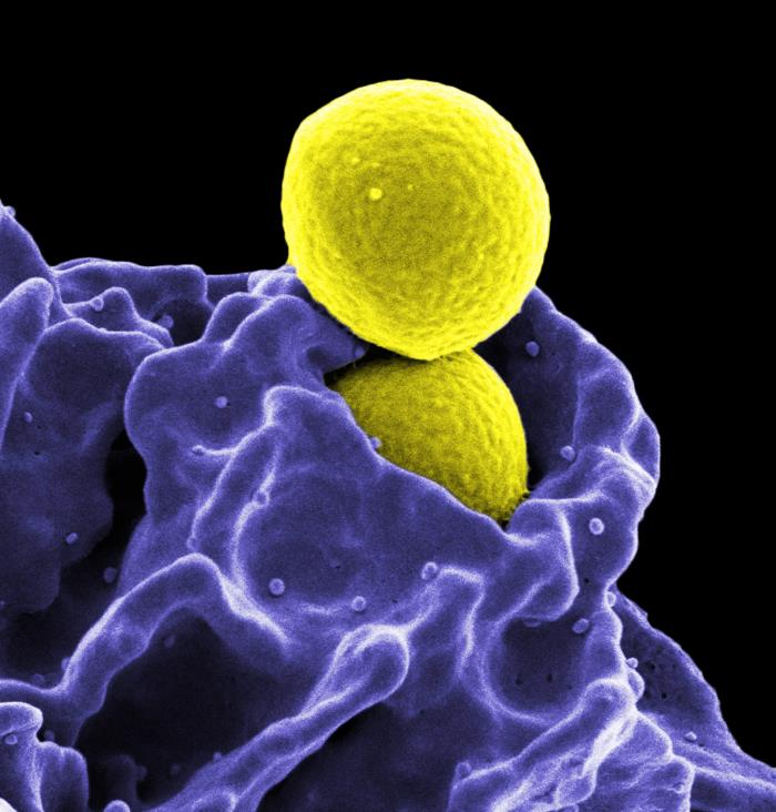 Image of MRSA bacteria