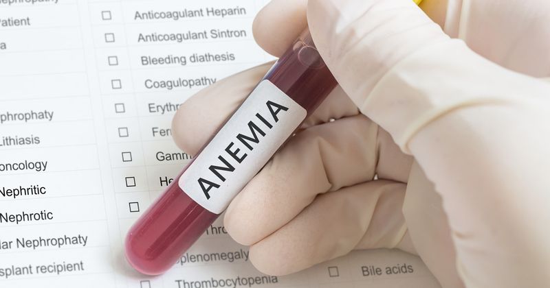 Doctor holding test tube labeled Anemia