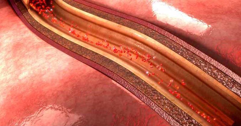 coronary arteries