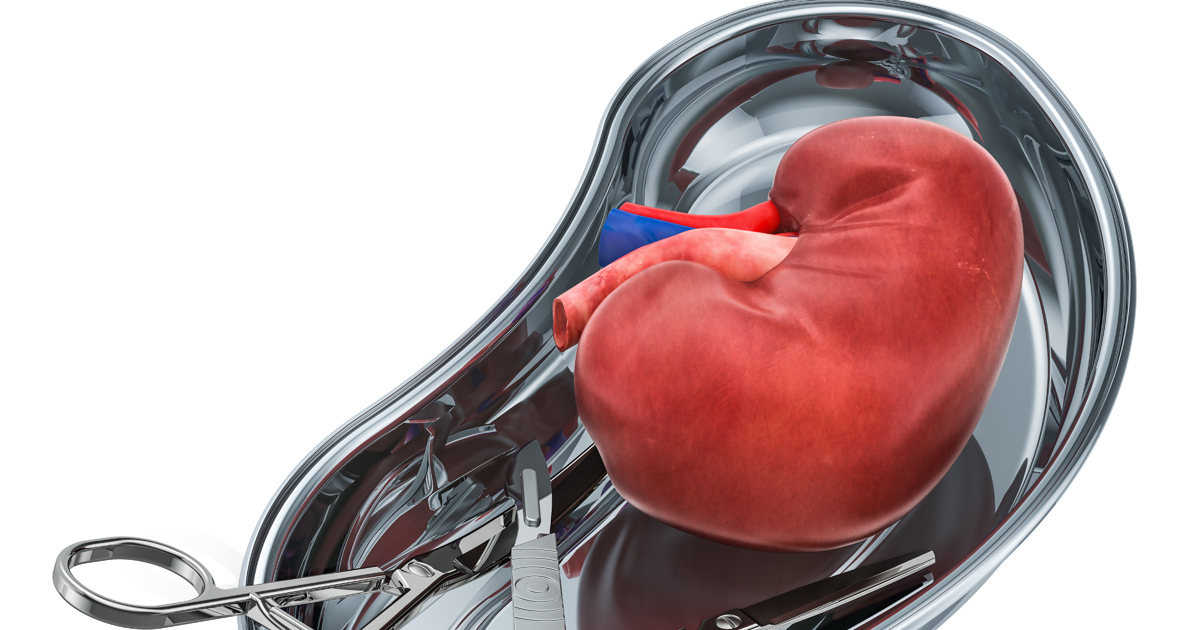 donor kidney