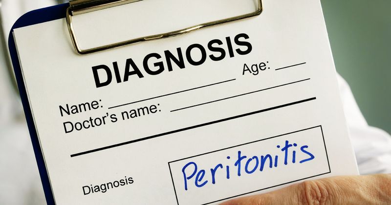 peritonitis