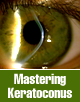 Mastering Keratoconus