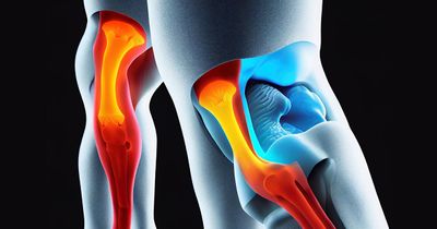 Delayed ACL reconstruction may risk meniscal, chondral pathology in adolescent patients