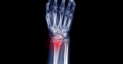 Clinical, nonclinical factors predict delayed fixation for 12% of distal radius fractures