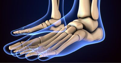 Minimally invasive hallux valgus correction may yield bony union at 6 months