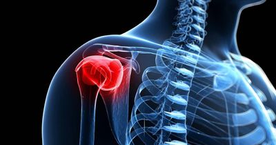 Rotator cuff repair with capsular reconstruction may prevent retears in high-risk patients