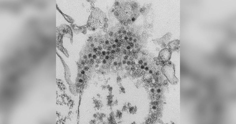 Enterovirus D68