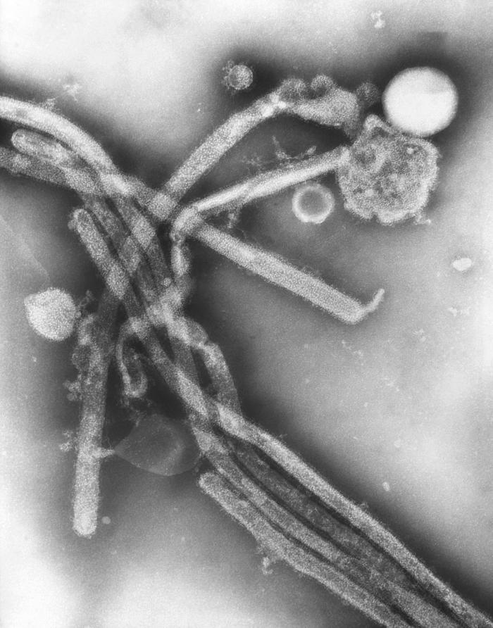 Image of H3N2 virons