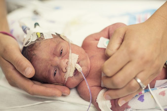 Photo of a preterm infant in hospital