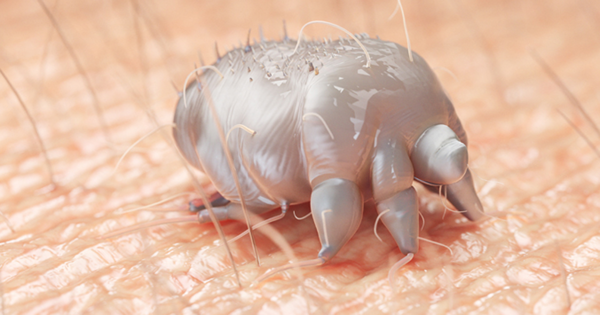 Photo of scabies mite