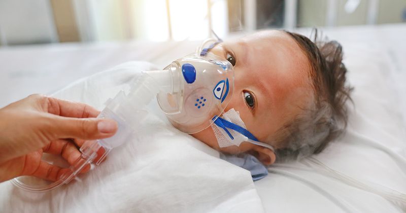 Baby with RSV wearing an inhalation mask