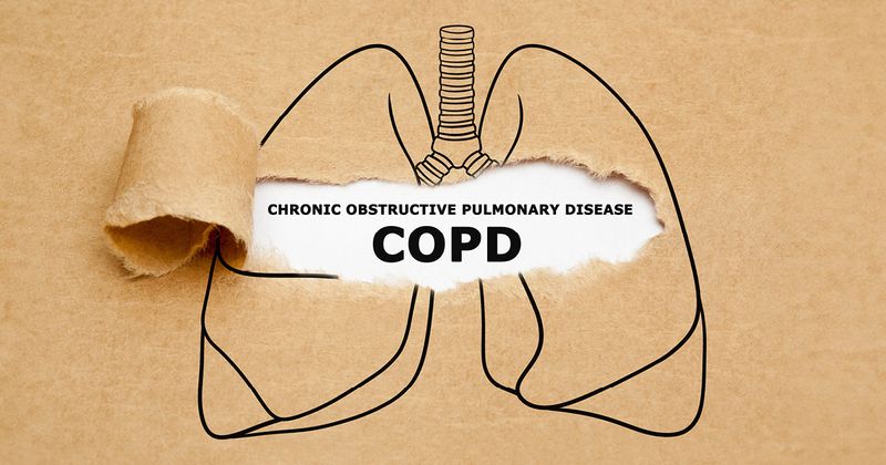 Drawing of lungs with COPD written inside.