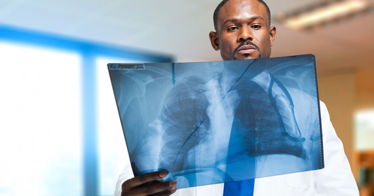 Doctor examining radiograph