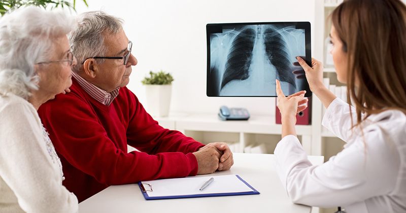 Doctor showing x-ray lung results to patients