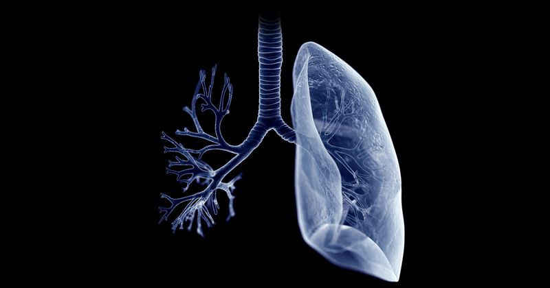 Lungs and bronchi